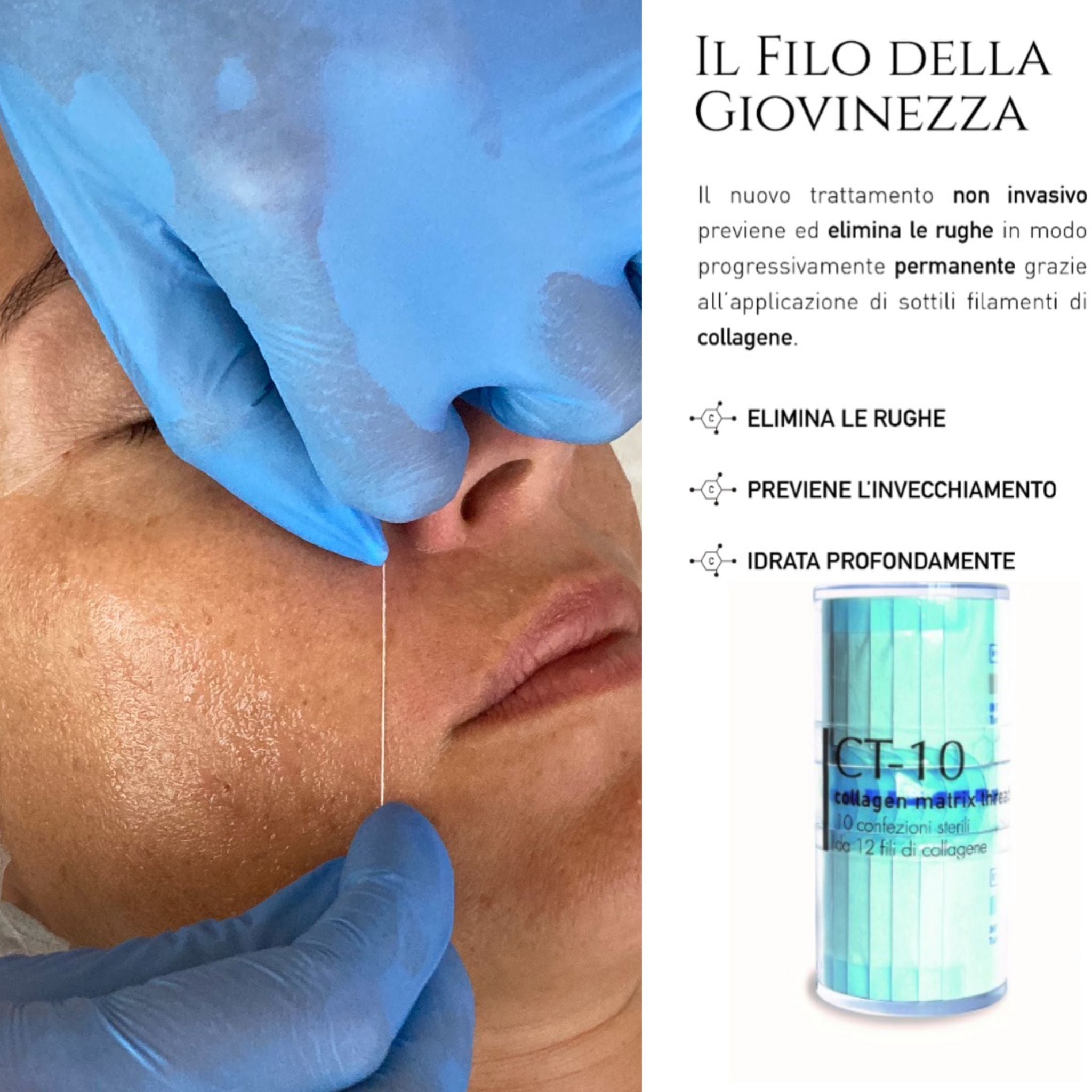 Ricarica Fili collagene idrolizzato cilindro 120 fili/10 bustine