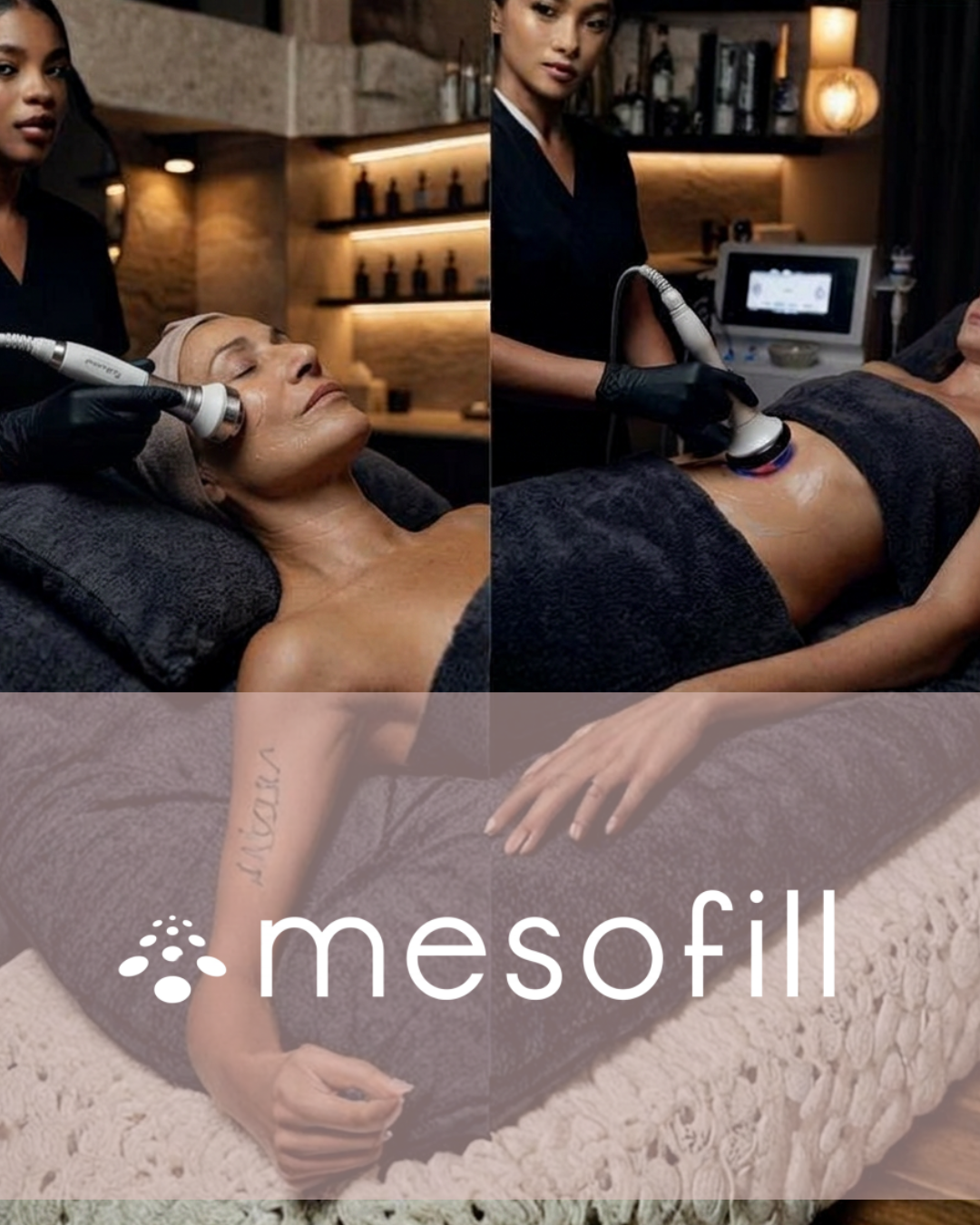MESOFILL PROFESSIONALI - FACE & BODY SYSTEM RF/ULTRASUONI